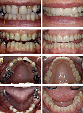 dentistry restorative treatments dental teeth changing life