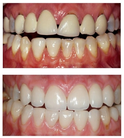 http://www.advanceddentistry.co.uk/wp-content/uploads/2012/04/Aesthetic-Dentistry.png