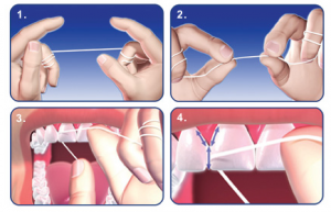 Diagram on how to carry out flossing