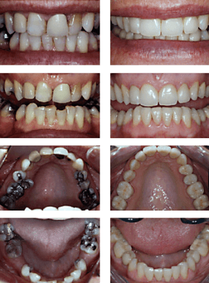 Dental work before and after