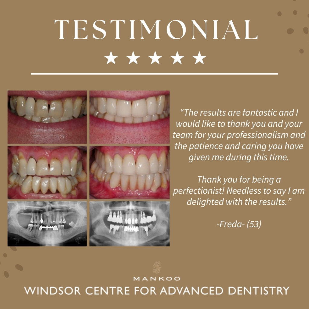 Restorative Dentistry Testimonial - Freda