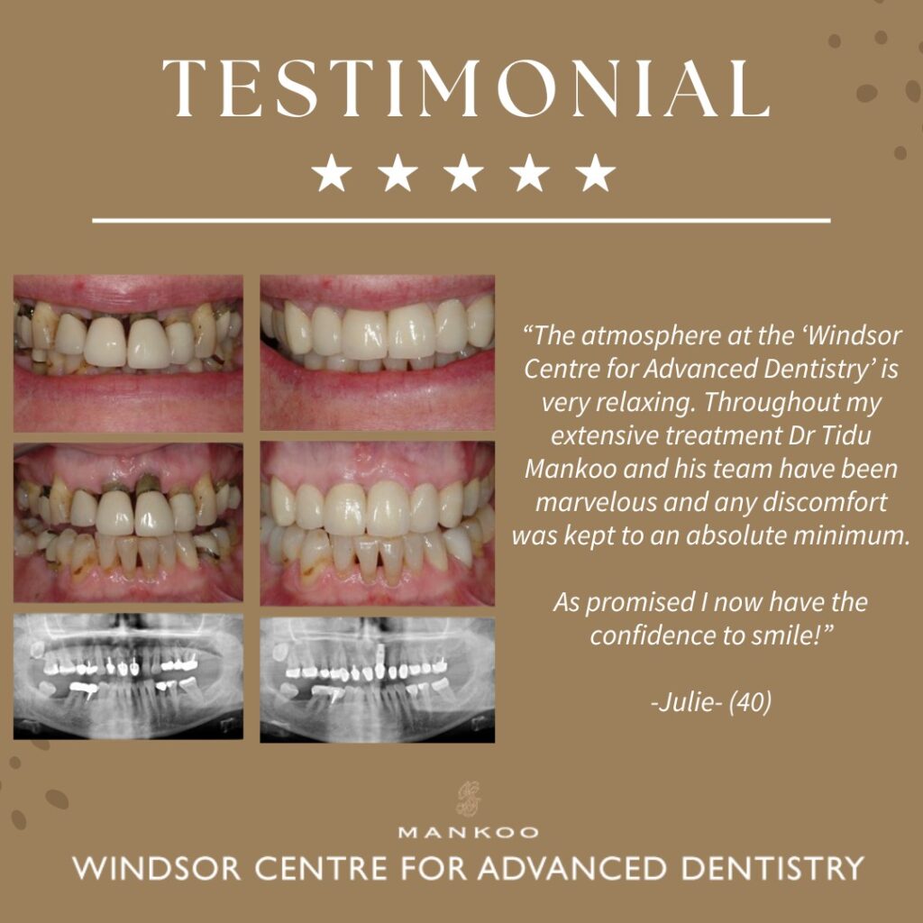 Restorative Dentistry Testimonial - Julie